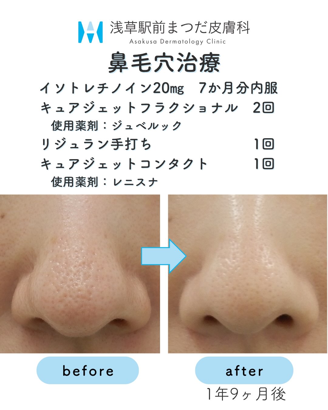 dr_matsuda_hiroki Facebook ad: 浅草駅前まつだ皮膚科の松田洋樹です
