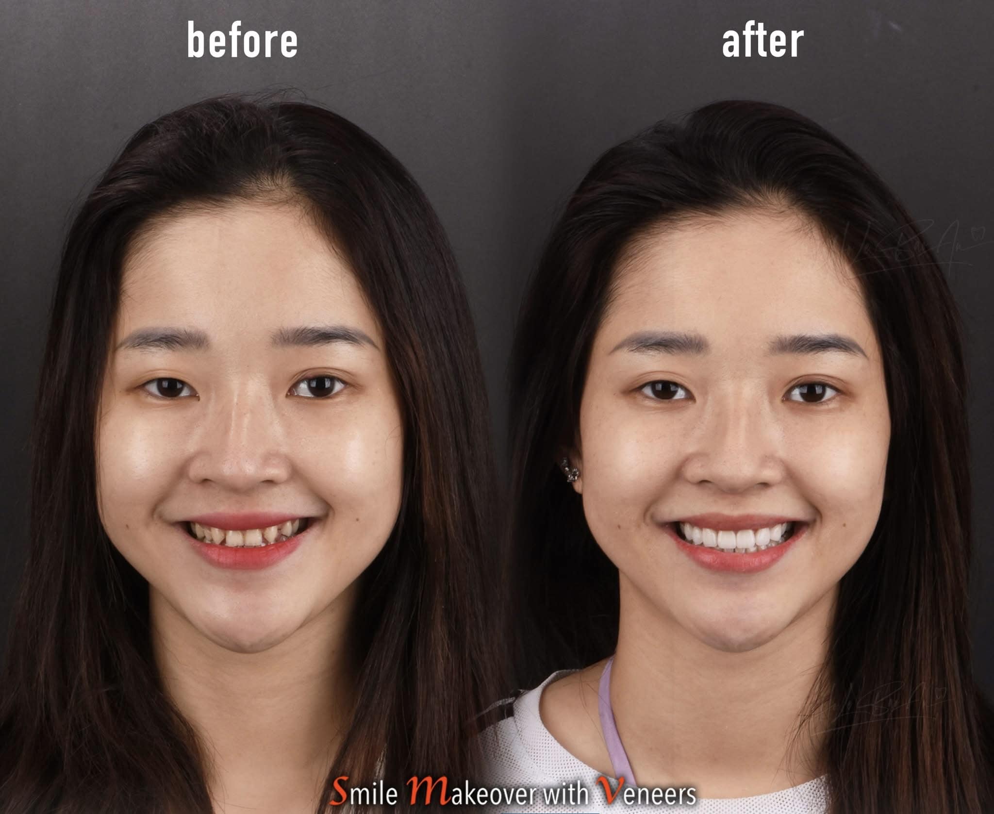 Delia Dental Clinic Facebook ad