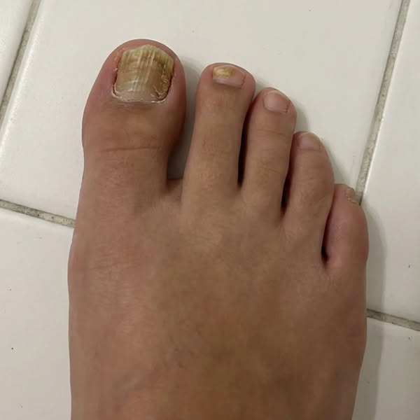 Sarah Mitchell Facebook ad: Doctor Secret About Nail Fungus You Didn't Know About