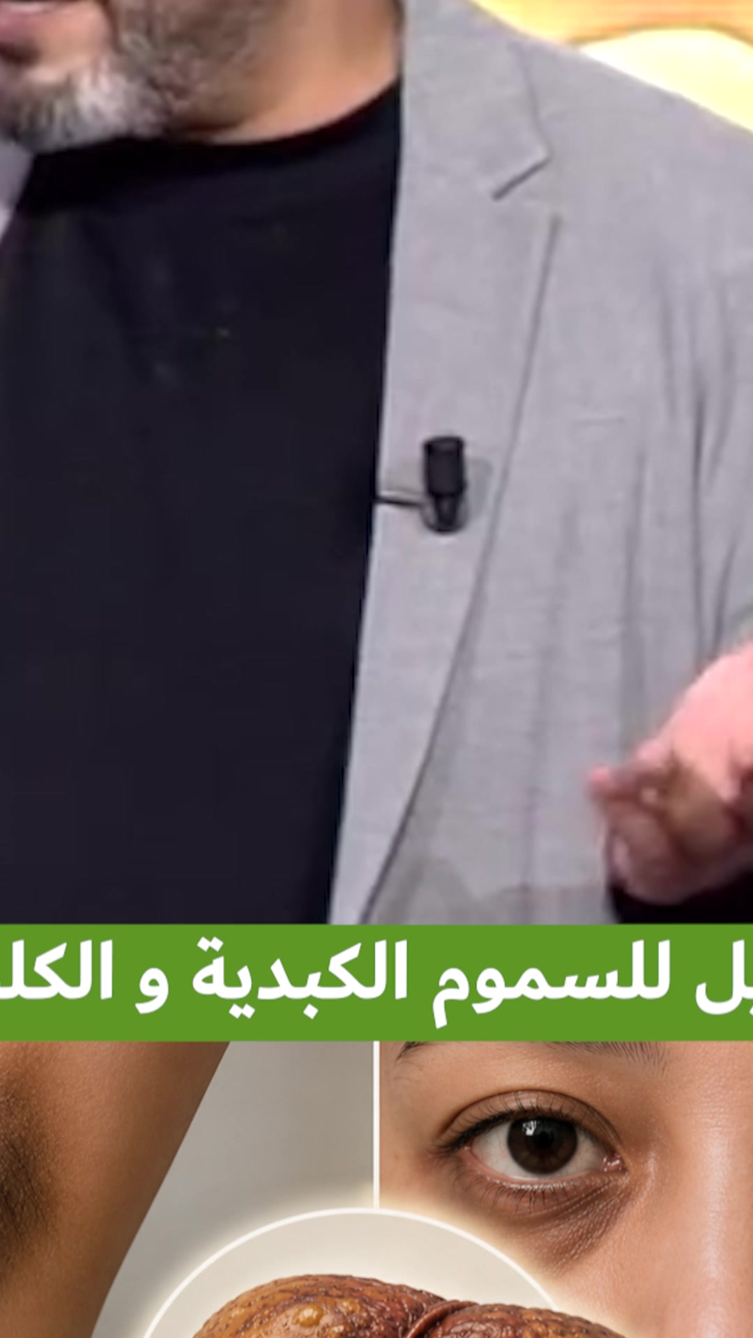 Shifa شفاء Facebook ad: رجّع طاقتك، صحّتك مع Liver Detox