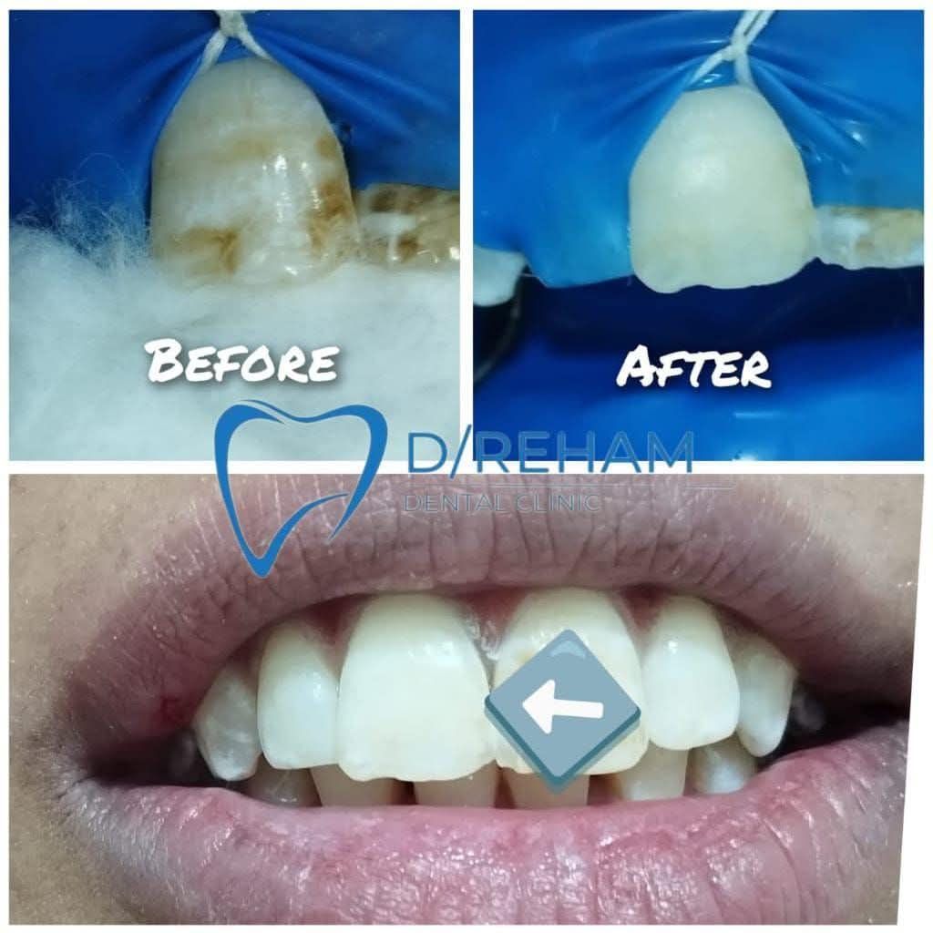 TAG DENT Facebook ad: vet kit for flurosis