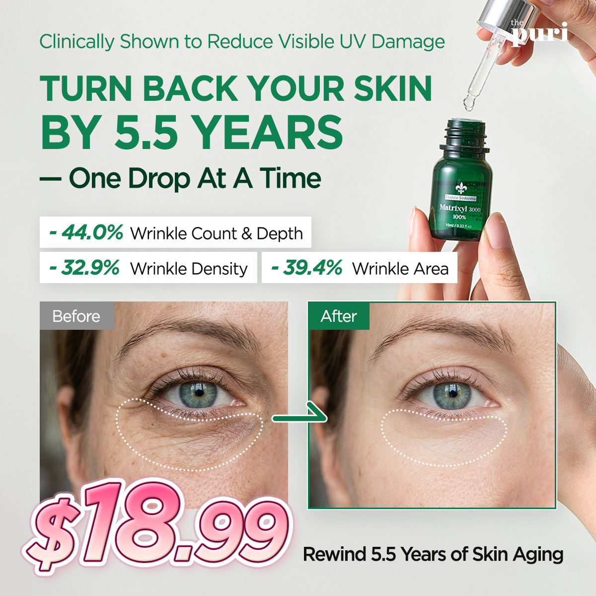 Thepuri Facebook ad: Matrixyl 3000 100% Peptide Serum