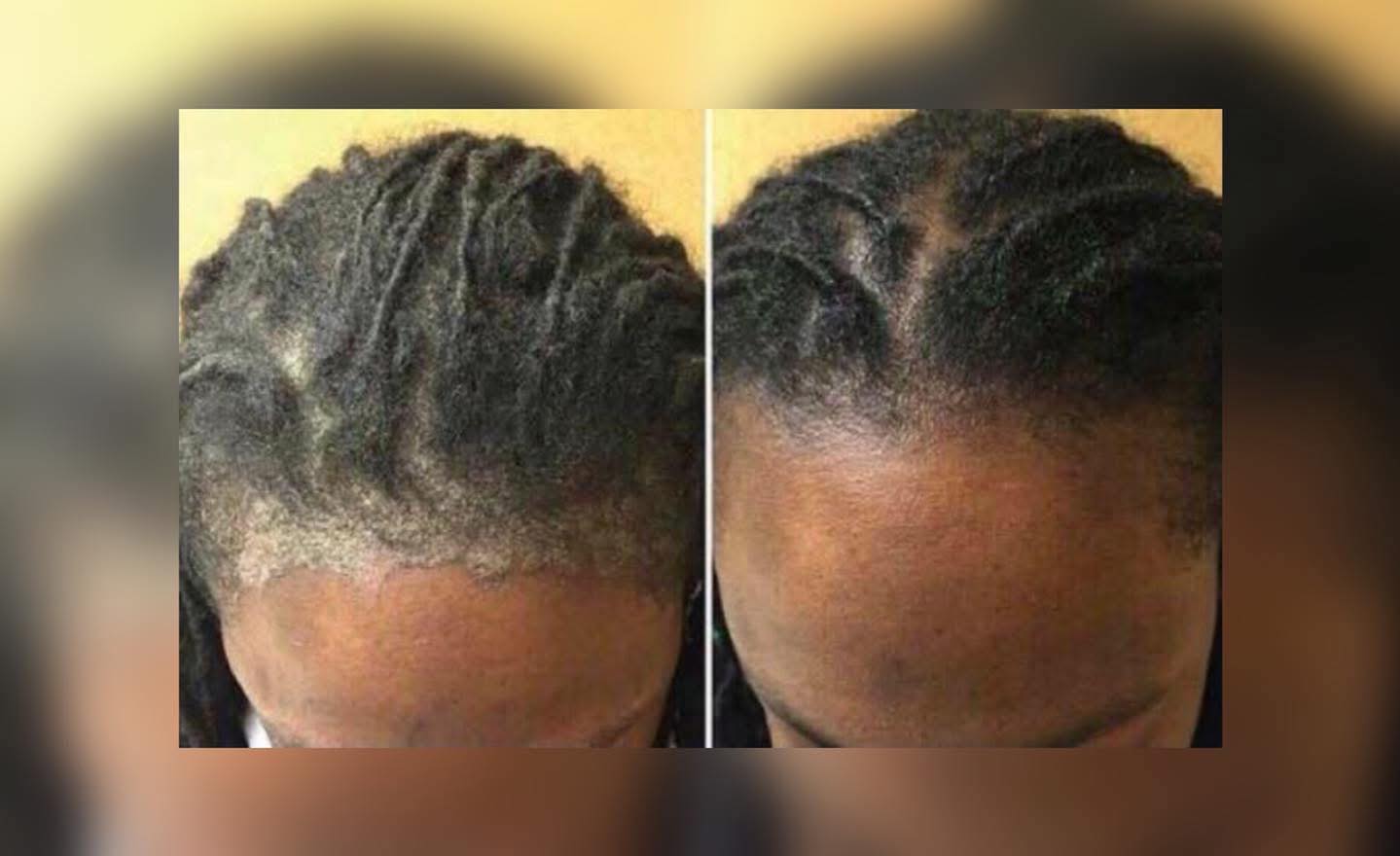 ONAGA cosmetics Facebook ad: SCALP AND SKIN SET AANGEVULD OP ONS HOOFD…