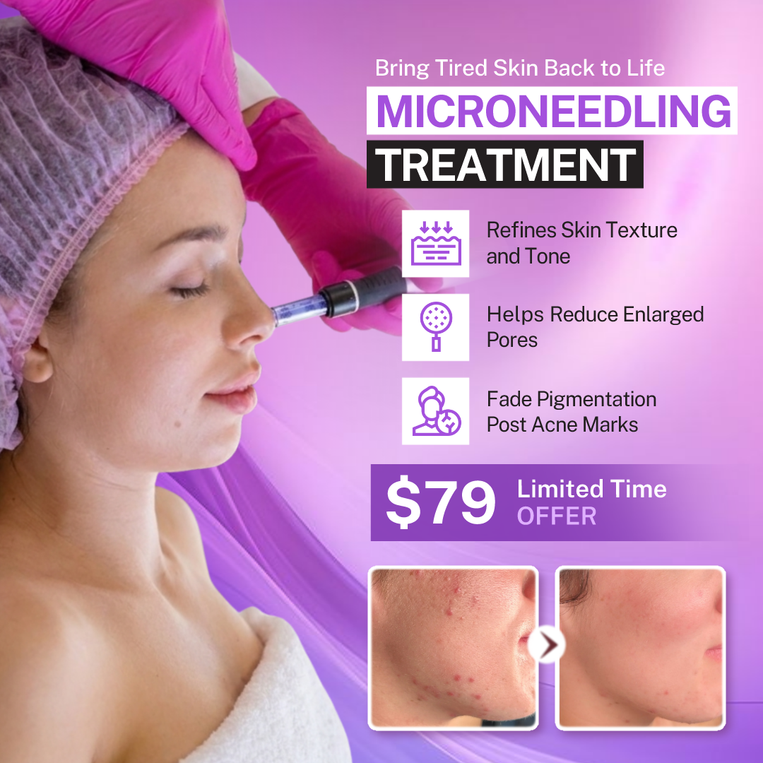 I Love Skin Treatments Facebook ad