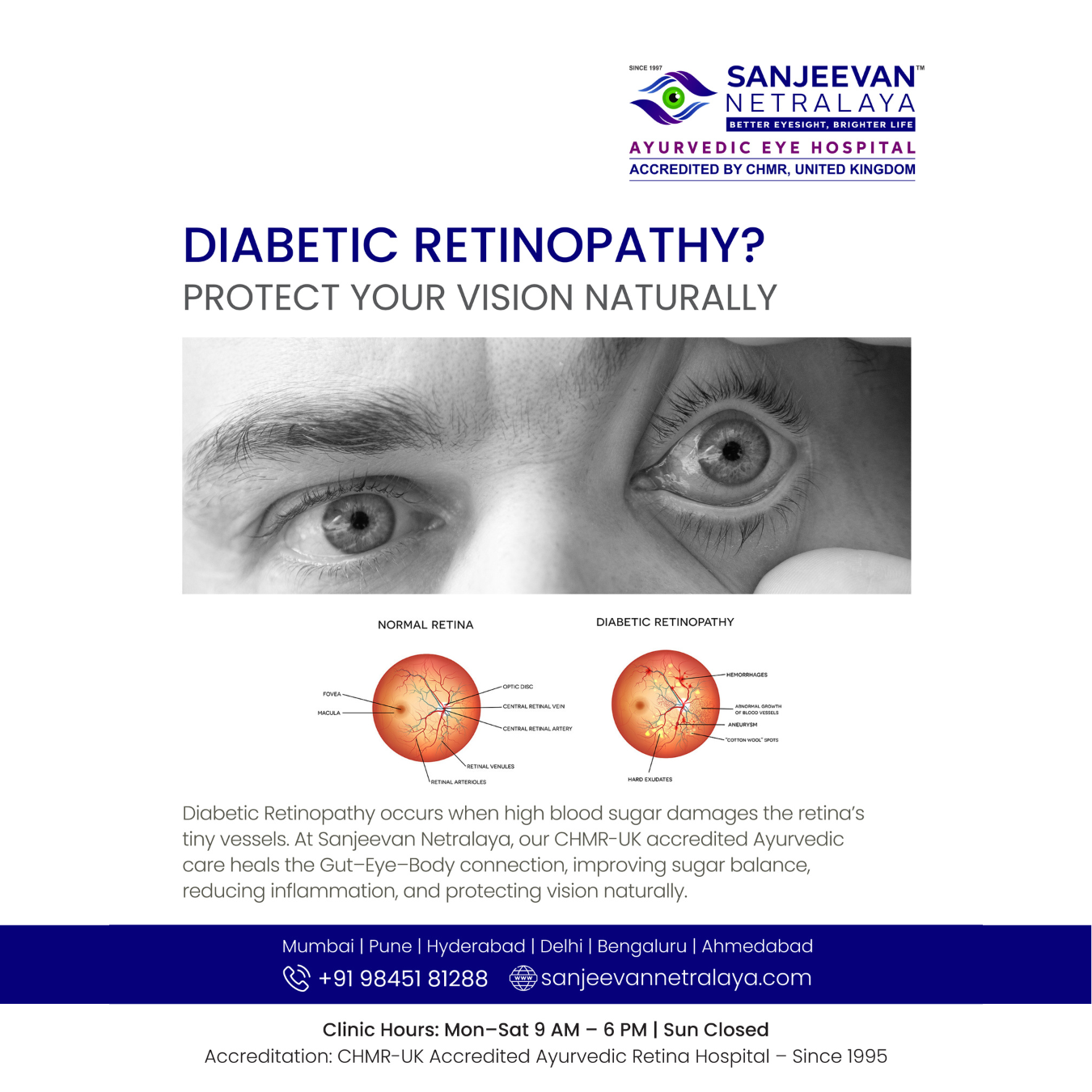 Sanjeevan Netralaya Eye Care  Facebook ad