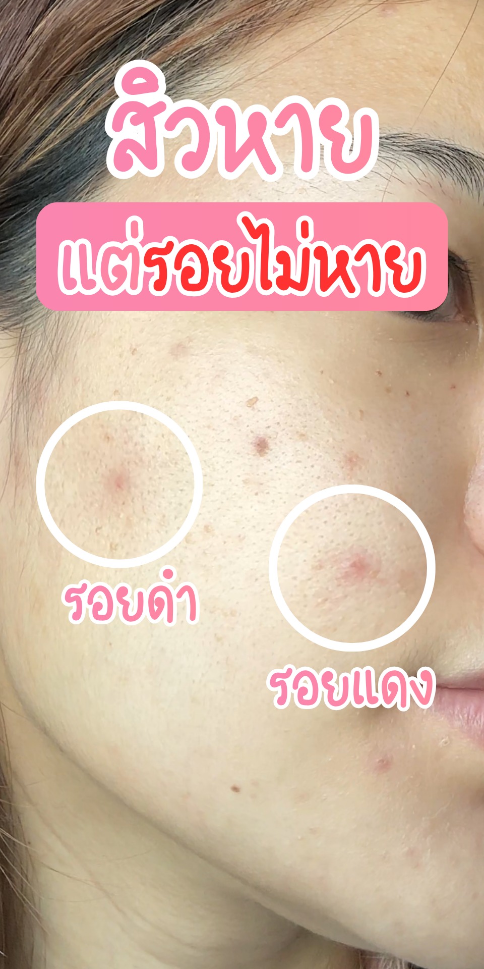 พอตอขอรีวิว Facebook ad