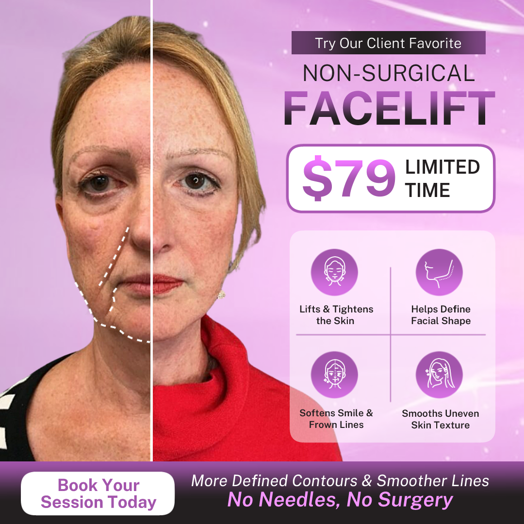 Skin Therapy Master Facebook ad: [Save $270] Try Our Non-Surgical Facelift For ONLY $79!