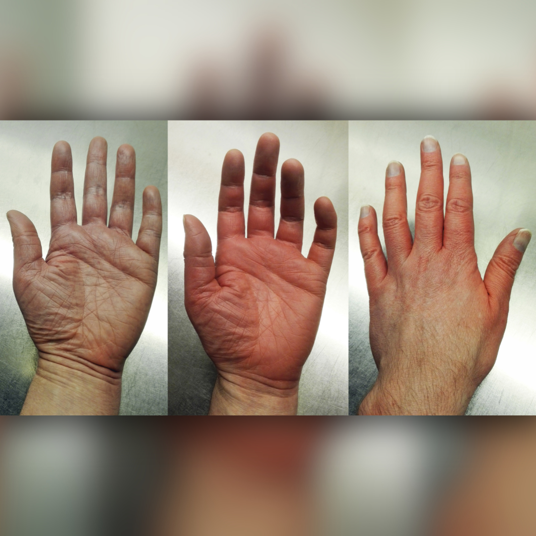 West TN Neuropathy Facebook ad