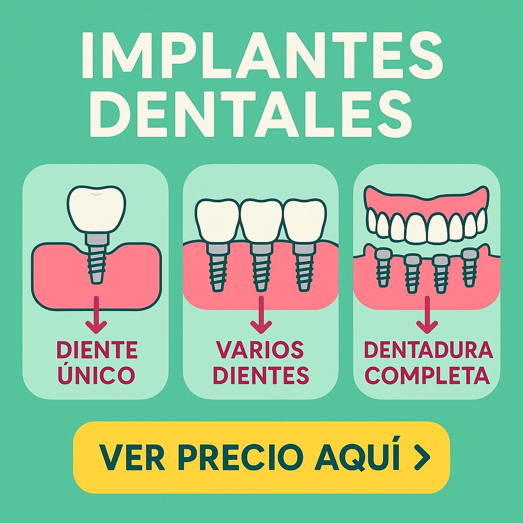 Crea vałor Facebook ad: Guía de implantes dentales 2026