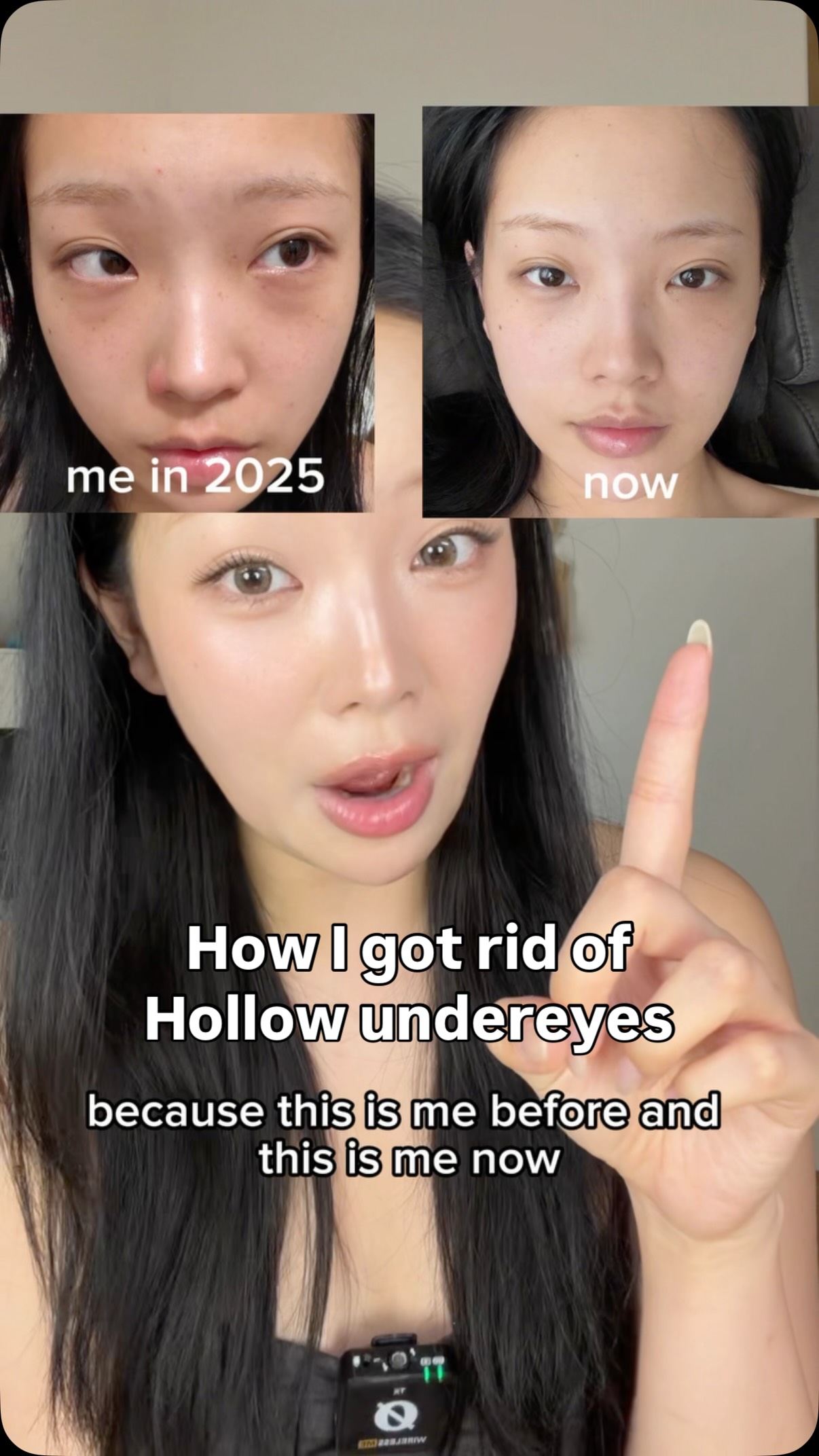 SKIN1004 Facebook ad: The cheapest and easiest way to get rid of undereye…