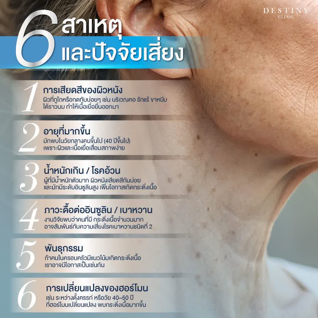 Destiny Clinic Facebook ad: กระ ติ่ง เนื้อ คืออะไร?