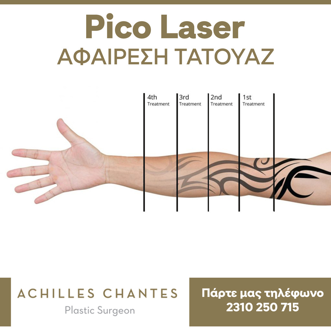 Πλαστικός Χειρουργός - Αχιλλέας Χαντές Facebook ad