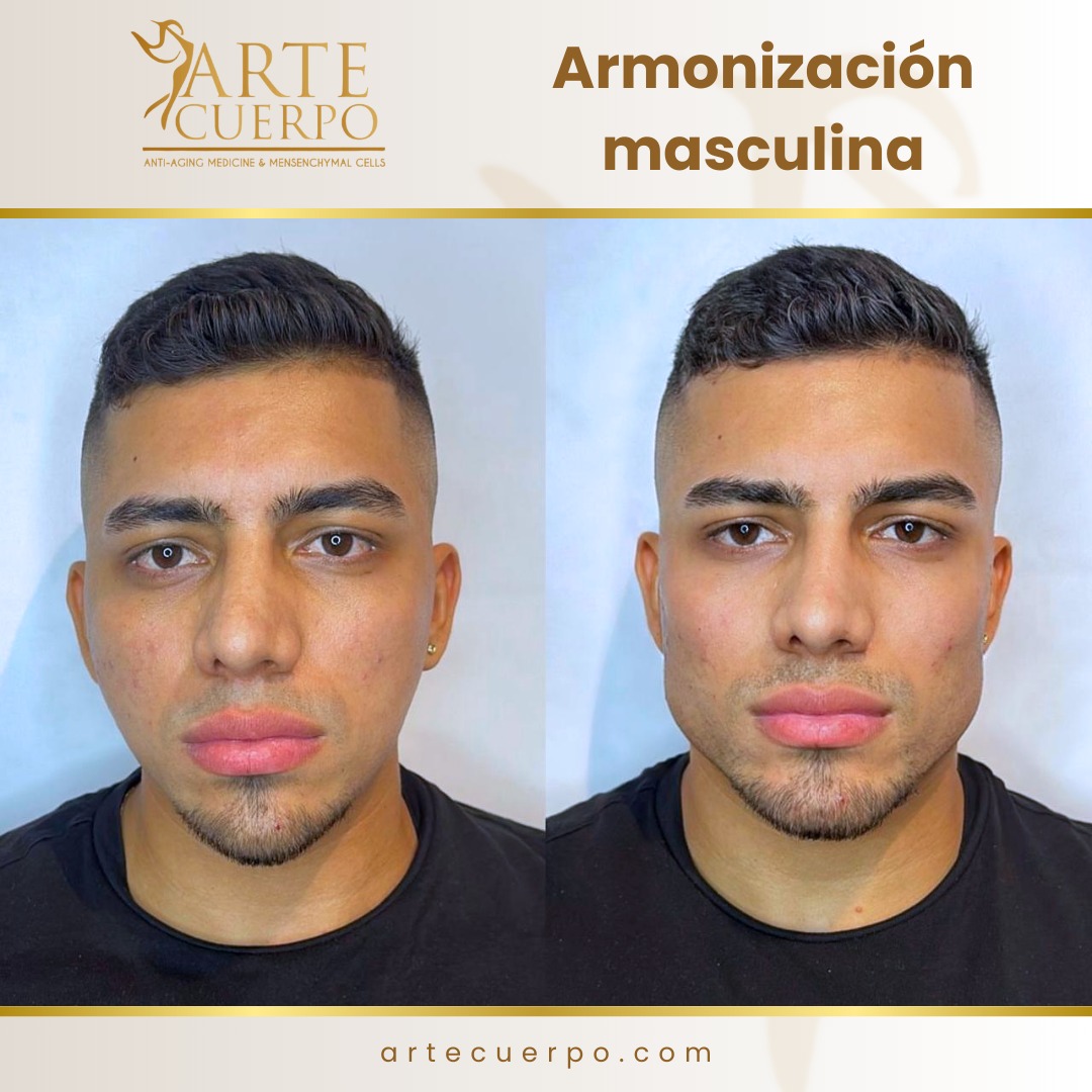 Clinica spa arte cuerpo  Facebook ad