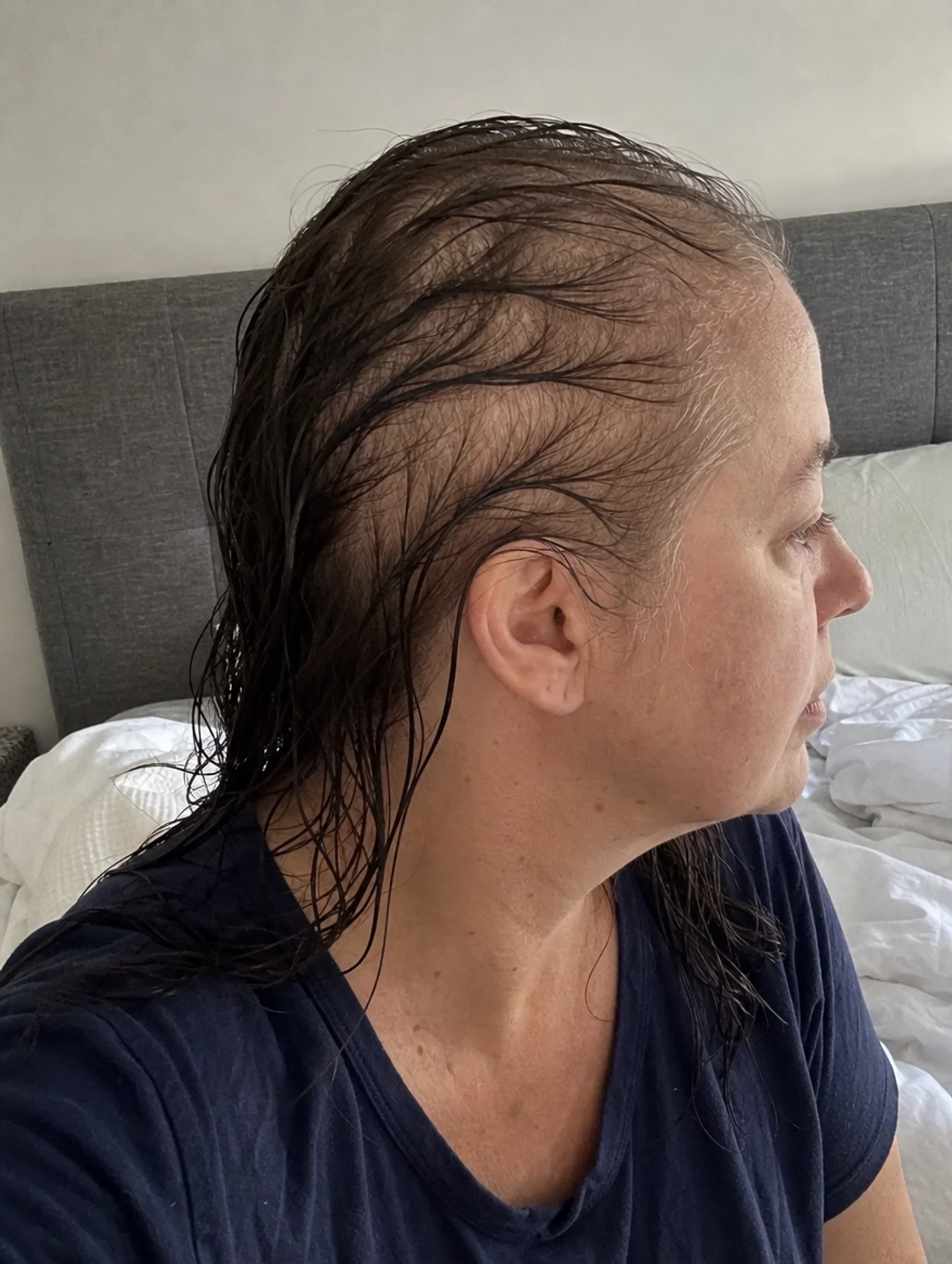 Better Life Facebook ad: Thyroid Hair Loss Explained