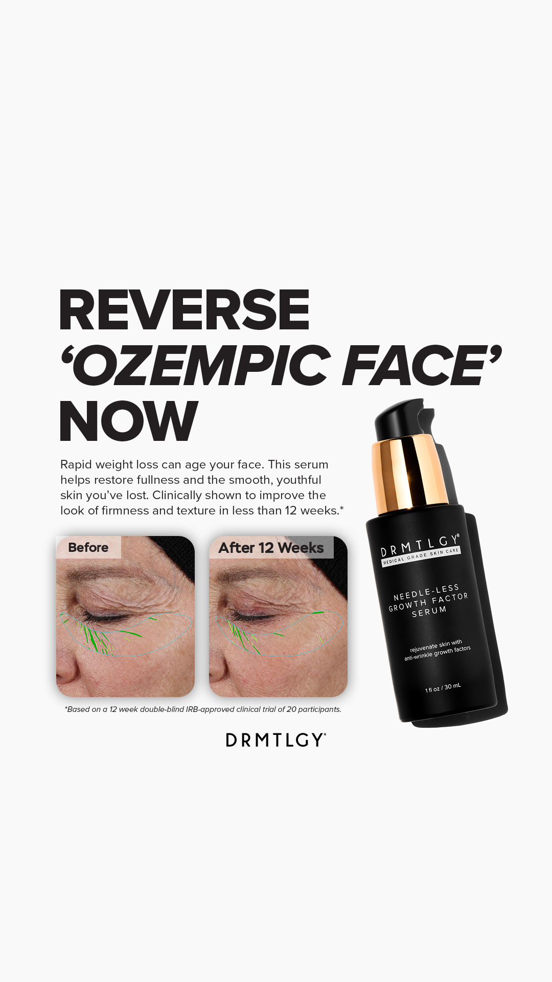 DRMTLGY Facebook ad
