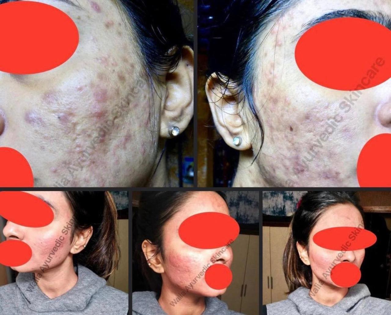 Waliaz Ayurvedic Skincare Facebook ad: SAT SRI AKAL JI