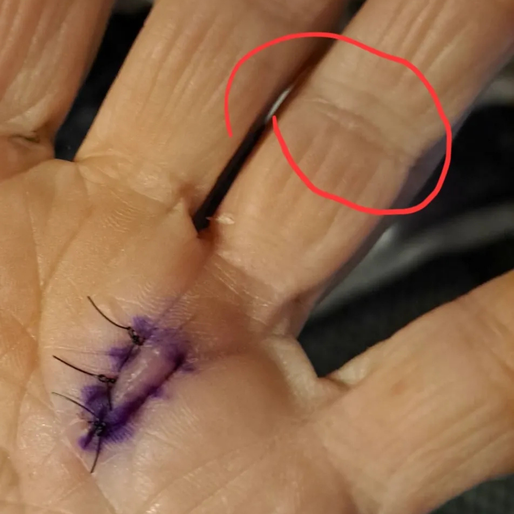 The Menopause Journal Facebook ad: Menopause did this to her hands