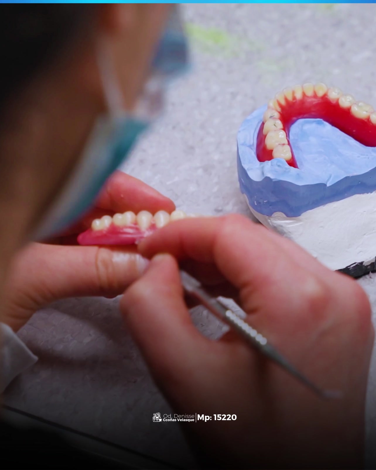 SmartDent Facebook ad from May 27, 2026