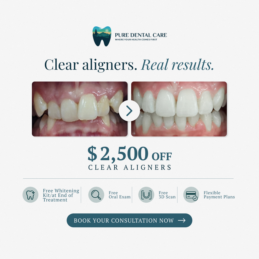 Pure Dental Care - Thornleigh Facebook ad: $2500 OFF Clear Aligner Special