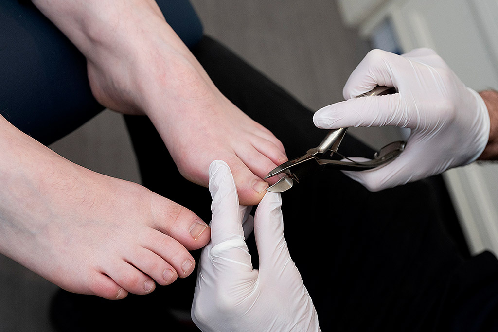 TFC Podiatry Facebook ad from Jun 17, 2026