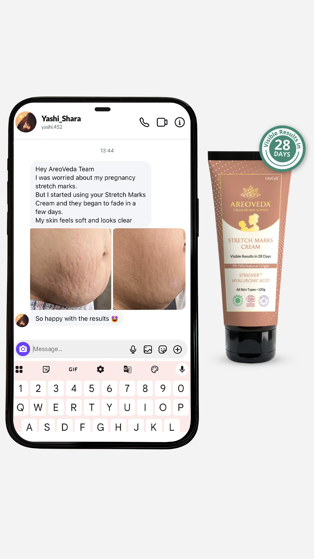 AreoVeda Facebook ad