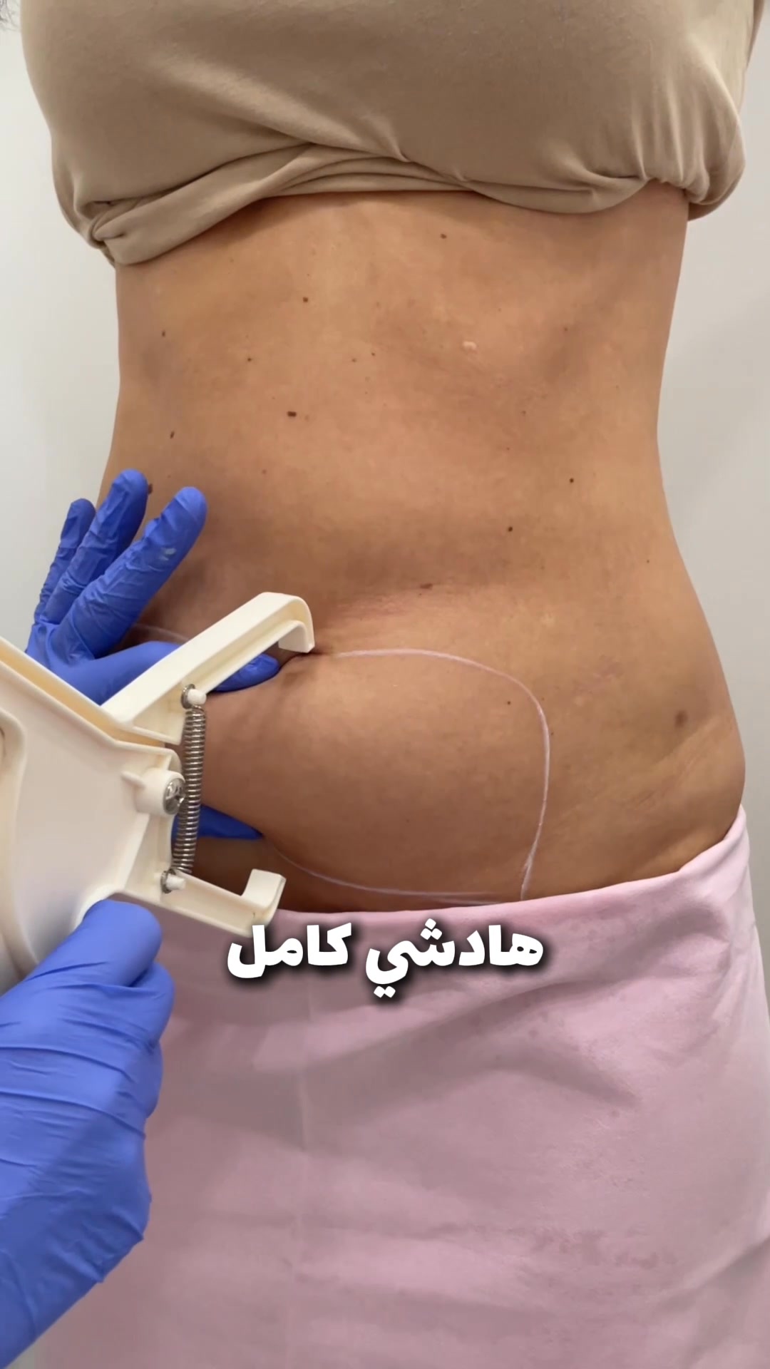 Cabinet d'Esthétique Médical Facebook ad: إحجزي موعد الآن | تشخيص مجاني 0667101887