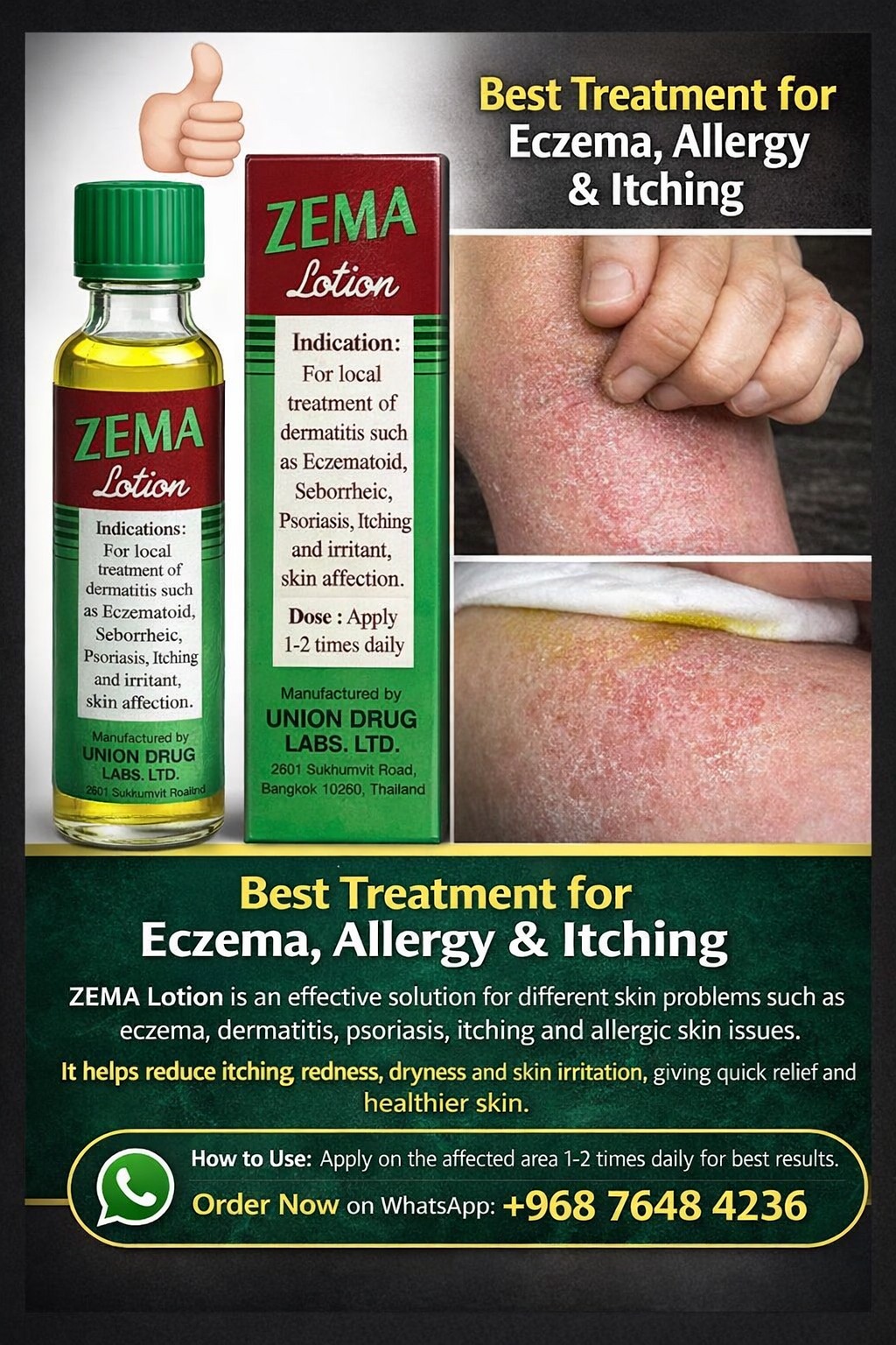 SAAD STORE Facebook ad: ZEMA Lotion, Effective Solution for Skin Problems