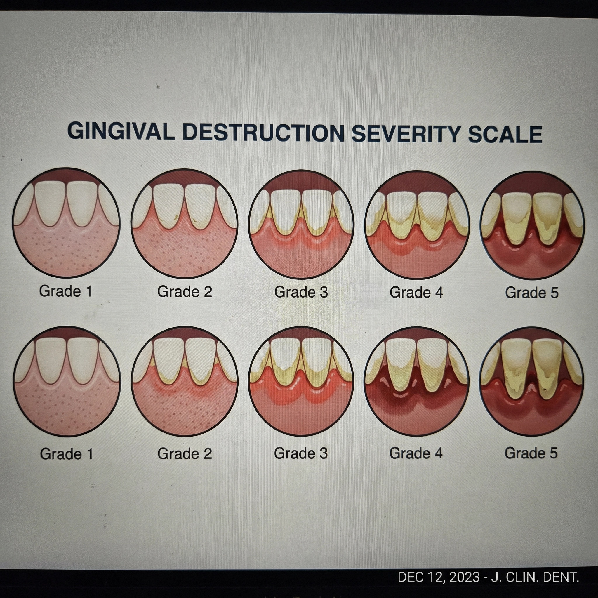 Receding Gums Reset Facebook ad