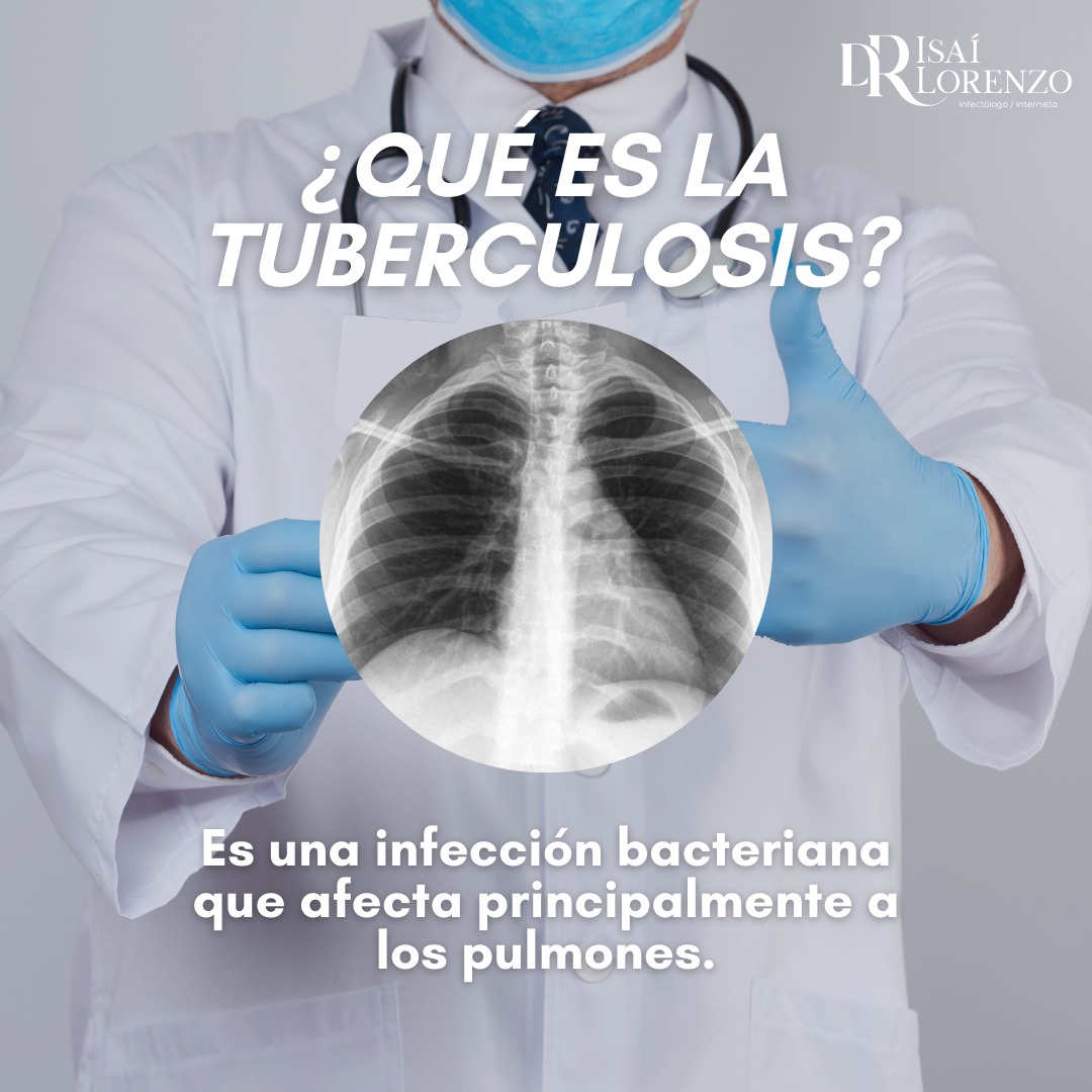 Infectólogo, Internista, Dr. Isai Guillermo Lorenzo Bautista Facebook ad: Detectarla a tiempo permite iniciar tratamiento y evitar…