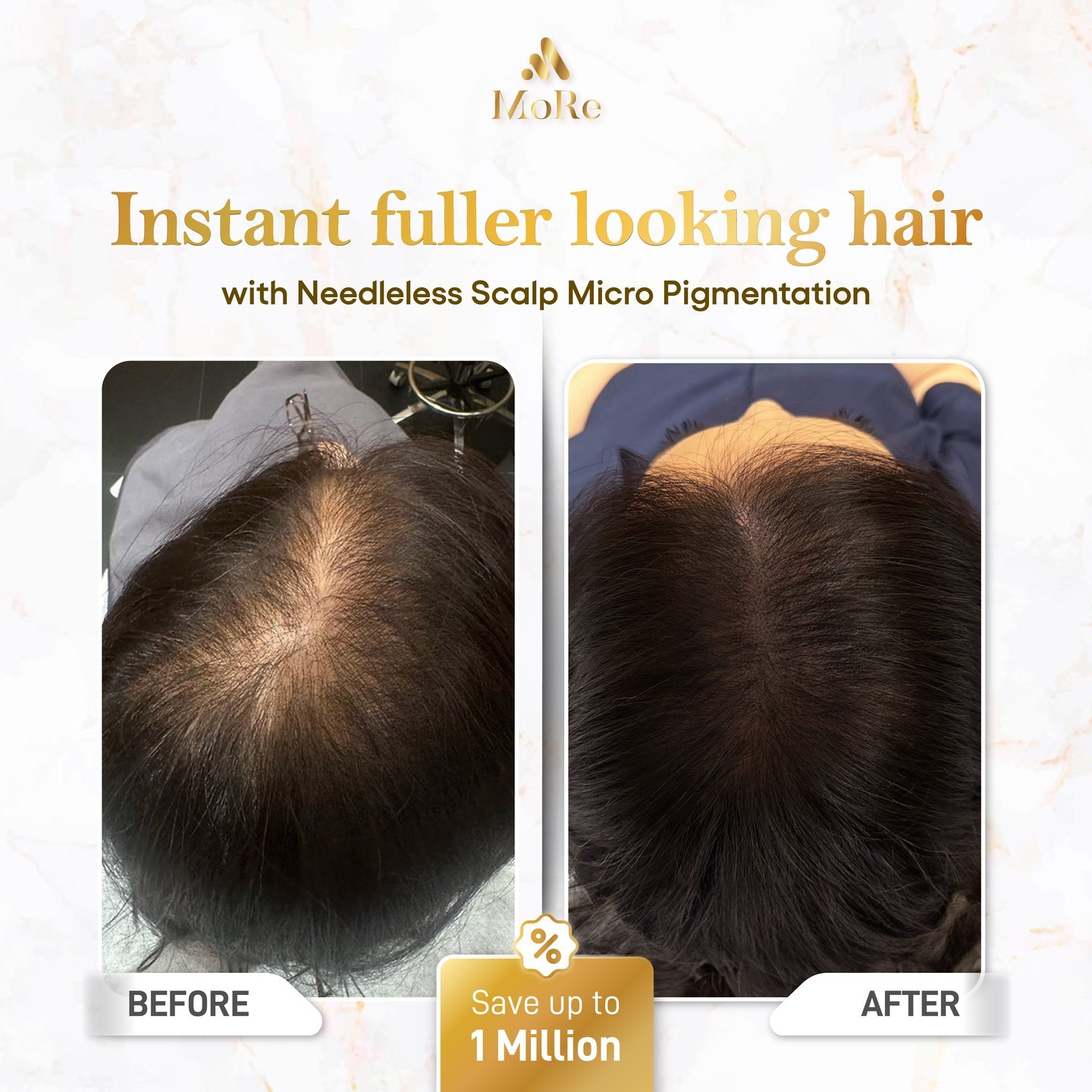 MoRe Hair Centre Facebook ad: In just 2 hours, bald spots be gone!