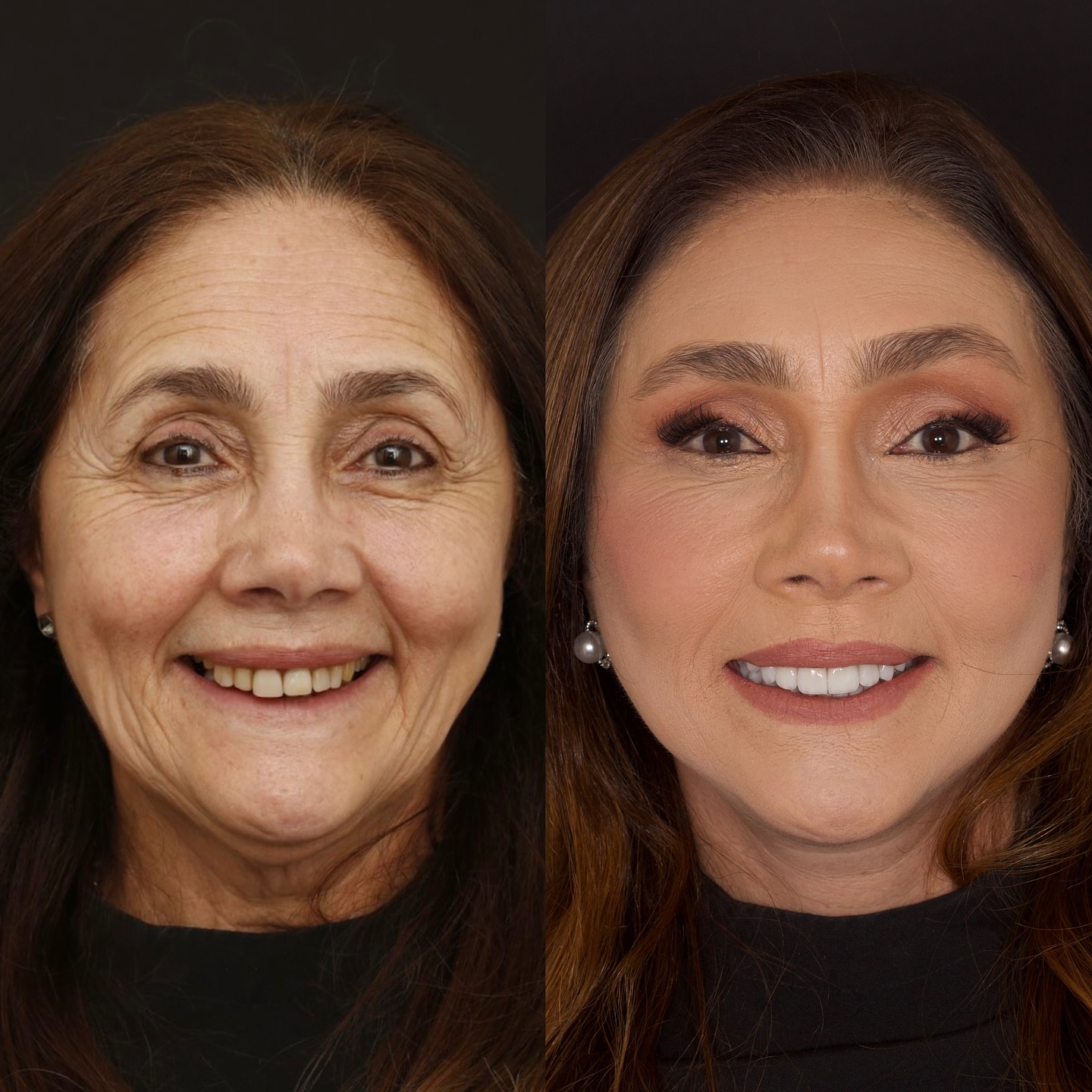 Rildo Lasmar Odontologia e Estética Facebook ad