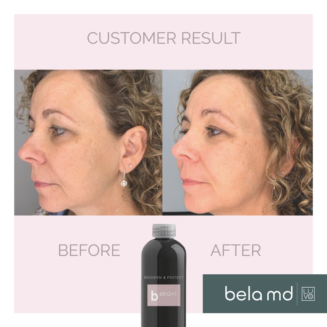 Laser It! Salon & Medical Spa Facebook ad: Begin with a complimentary skin analysis to uncover…