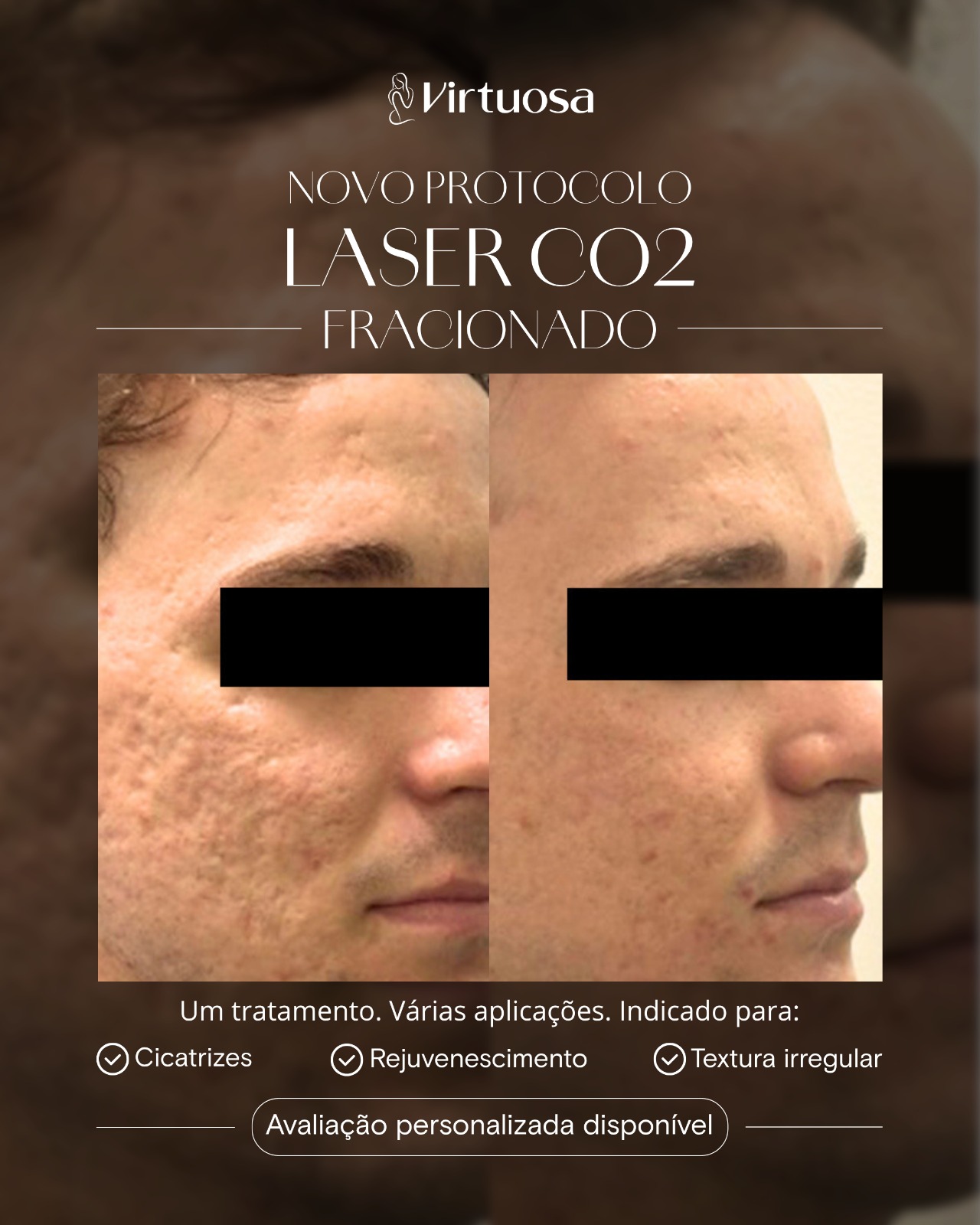 Clínica Virtuosa - Brusque Facebook ad from May 20, 2026