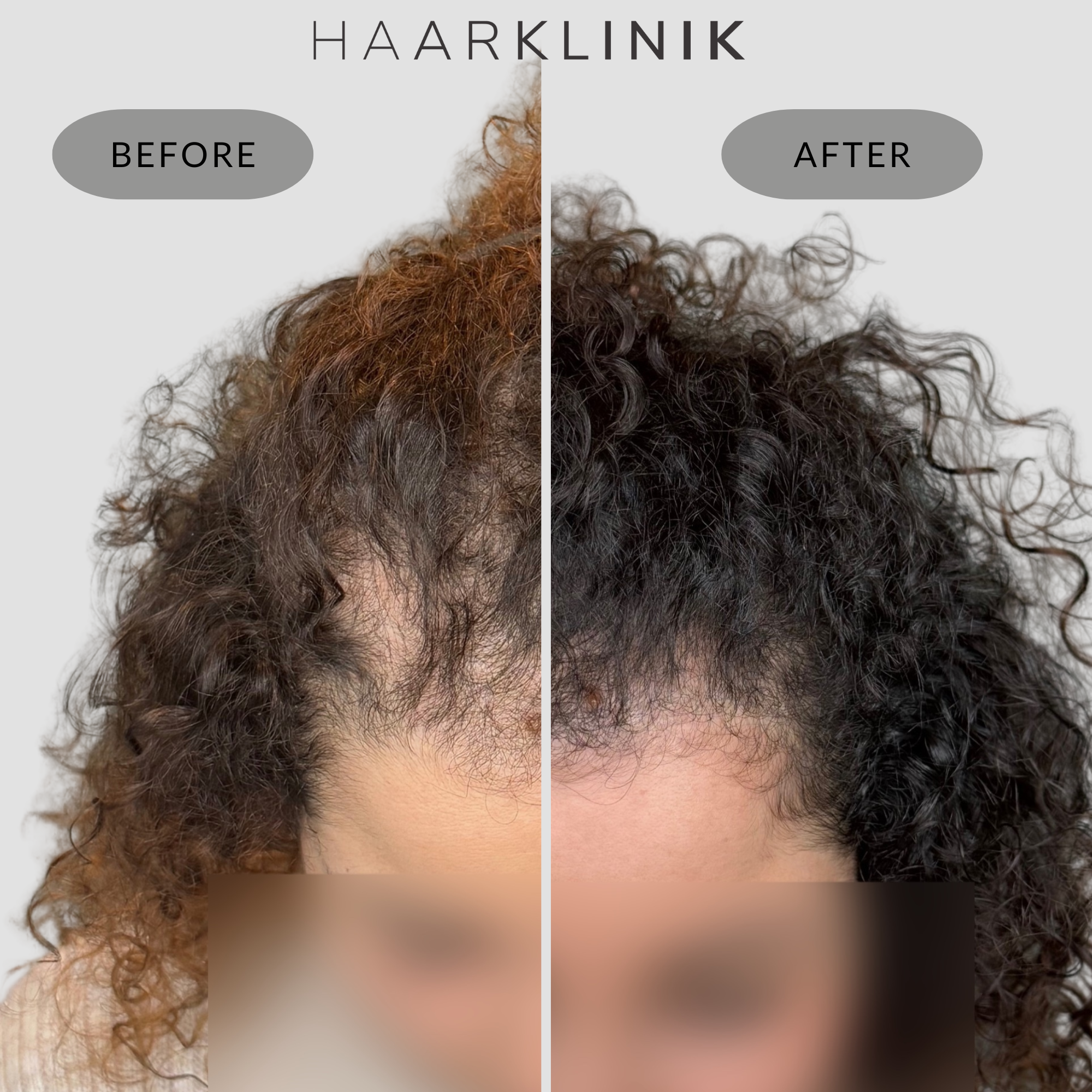 Haarklinik Facebook ad
