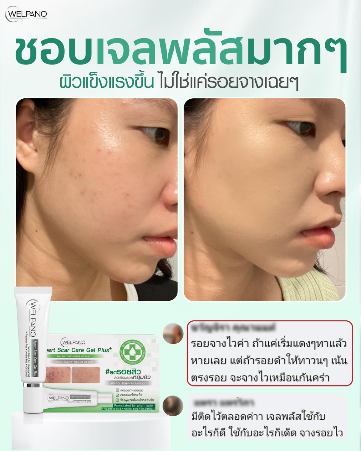 Welpano Cosmetics : เวชสำอางโดยเภสัชกร Facebook ad