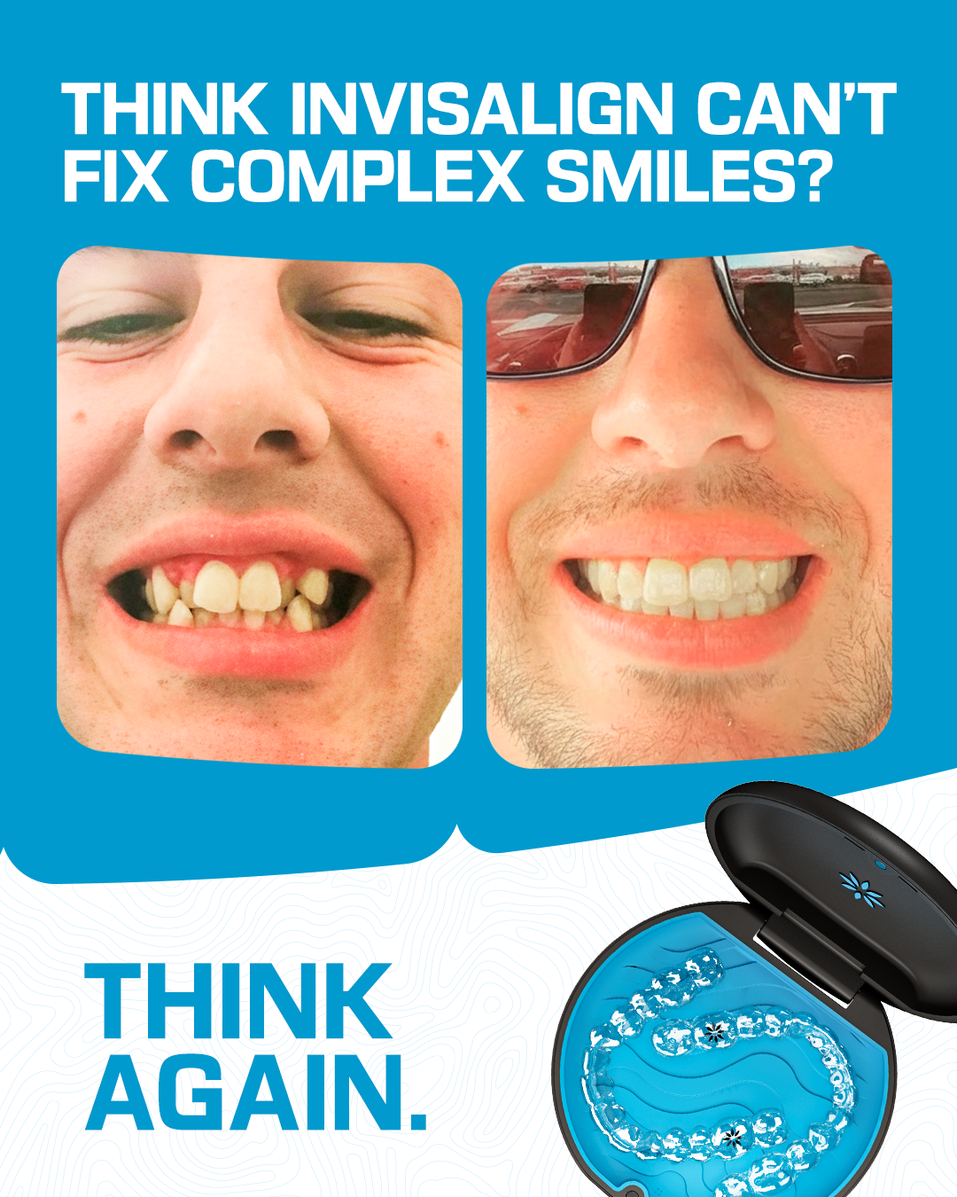 Invisalign Facebook ad