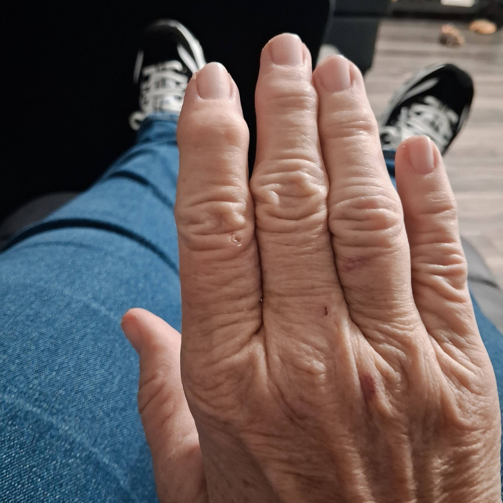 The Menopause Journal Facebook ad: Menopause did this to her hands