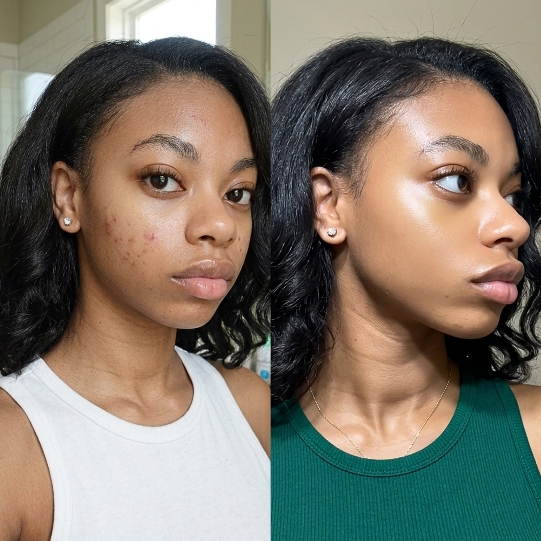 Keisha's Skin Care Journey Facebook ad