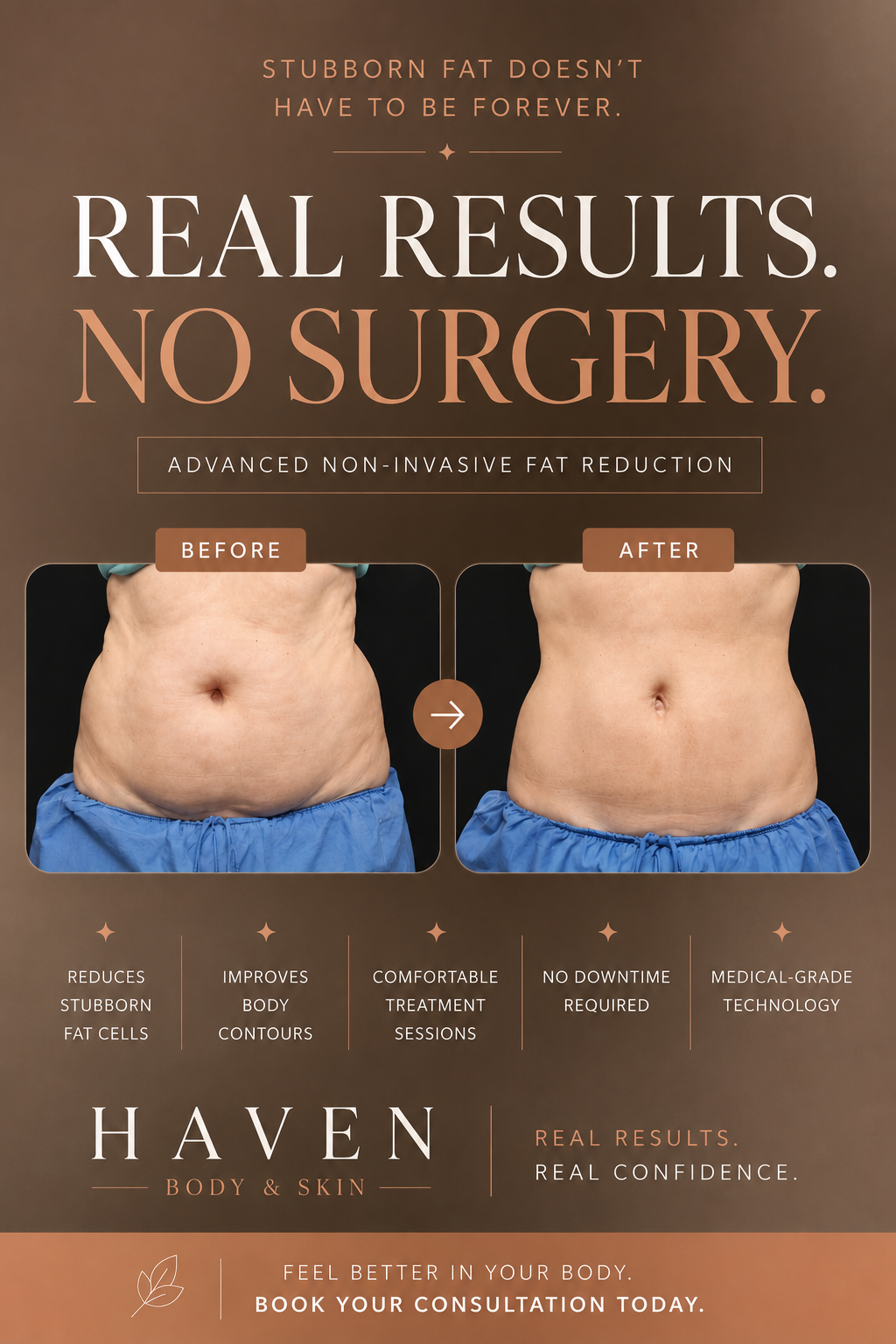 Haven Body & Skin Facebook ad: Body Contouring & Skin Tightening Treatments