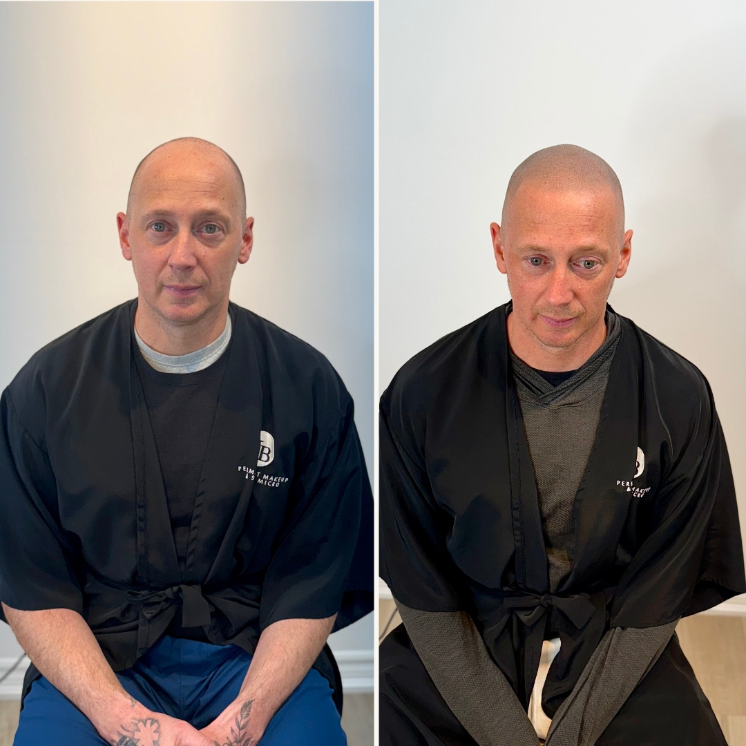 Unyozibeauty Facebook ad: Hair Loss Ends Here!