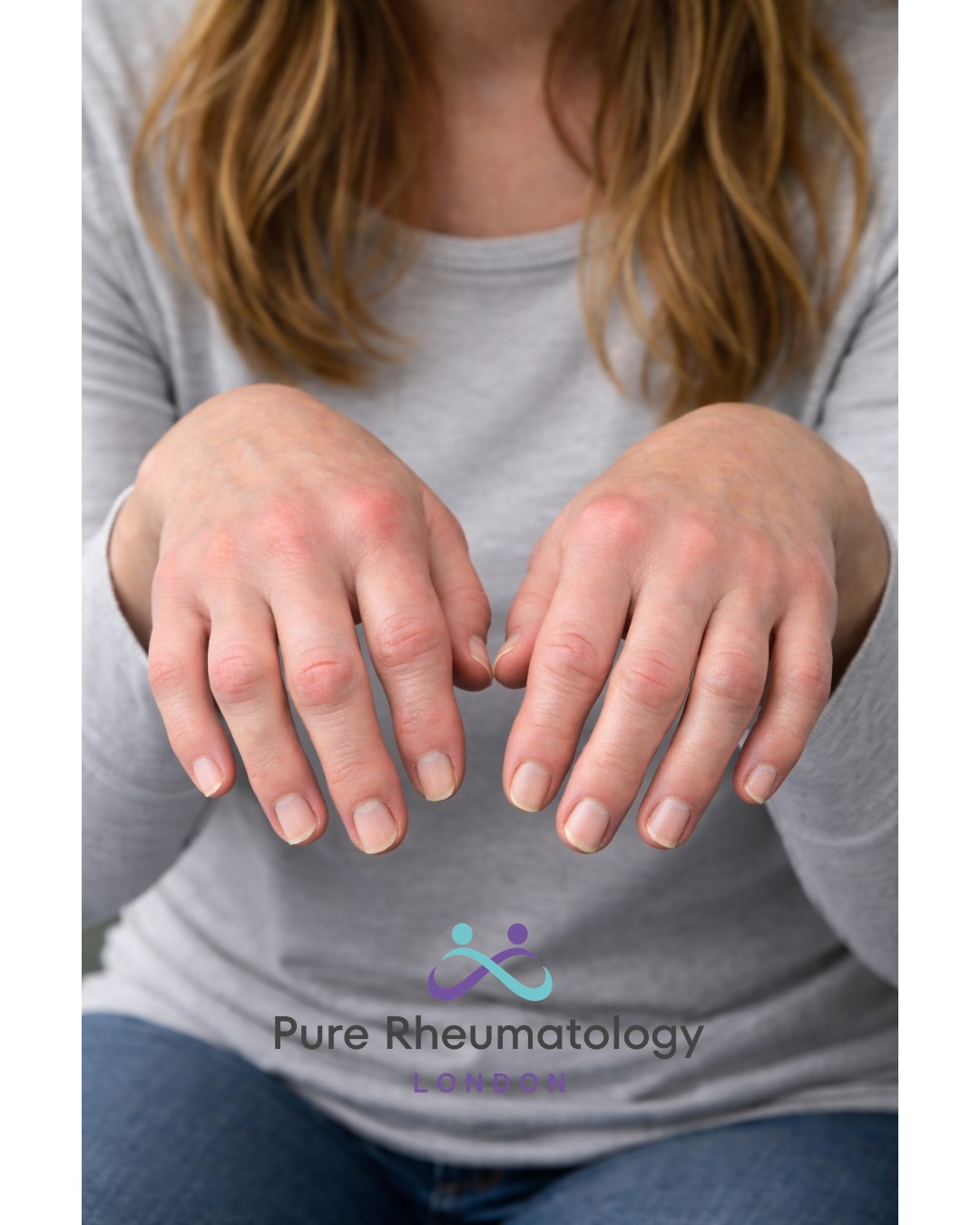 Pure Rheumatology London Facebook ad: Early Rheumatoid Arthritis: Rapid Diagnosis & Treatment |…