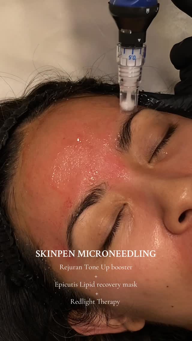 Labelleviemedspa Facebook ad: The Ultimate Skin Glow-Up