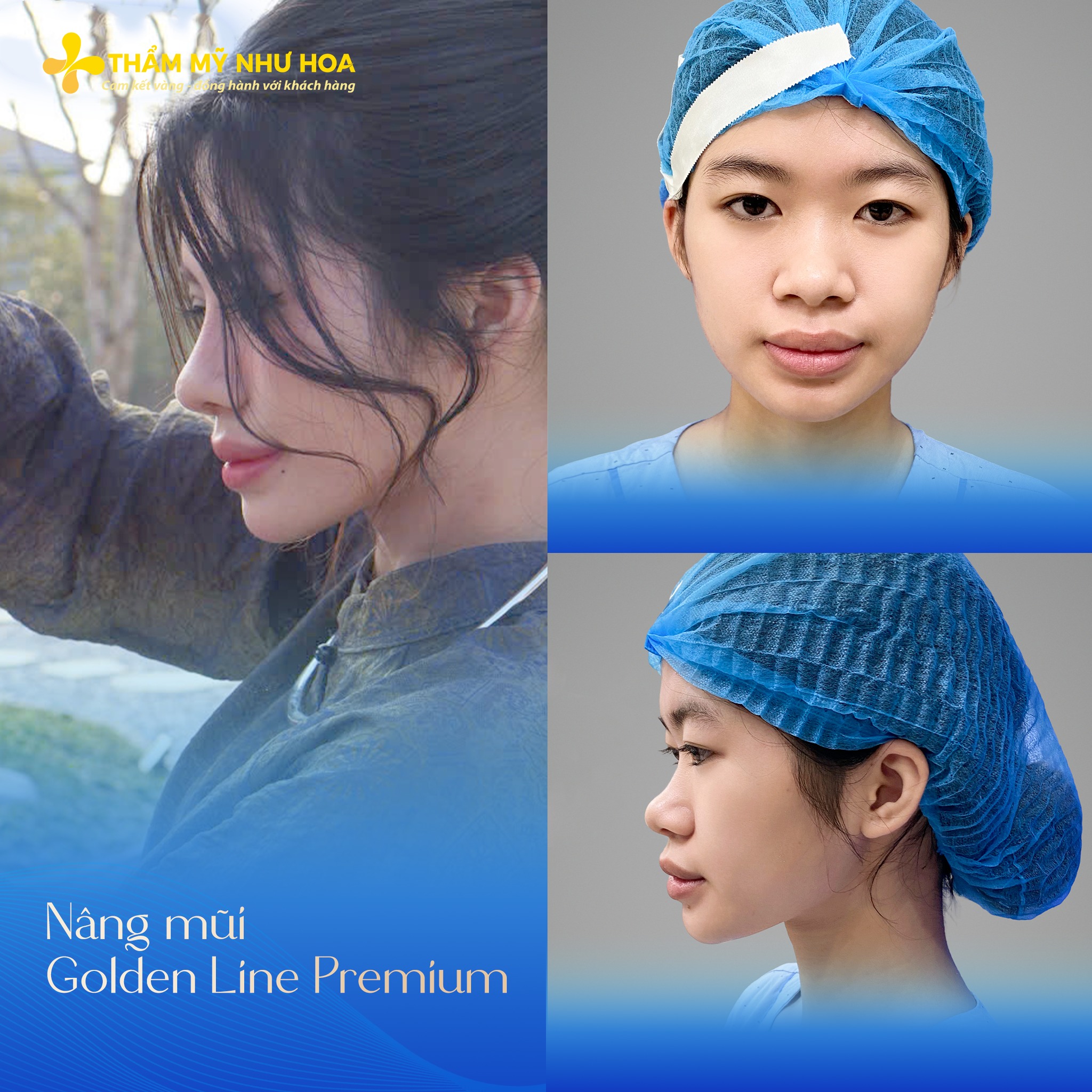 Thẩm Mỹ Như Hoa Facebook ad: Nâng xong em có cảm giác như chưa…
