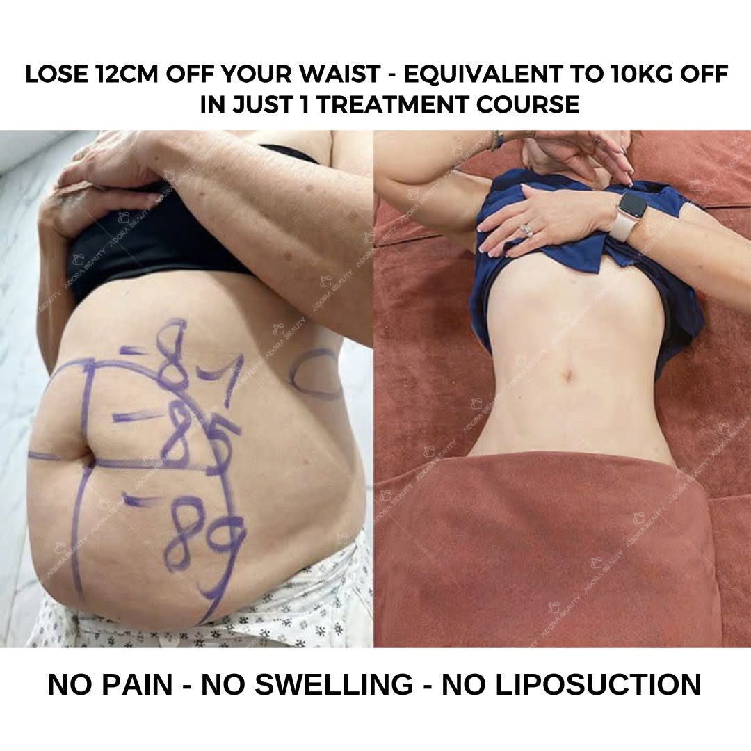 ADORA Beauty - Slimming Aesthetic Center Facebook ad