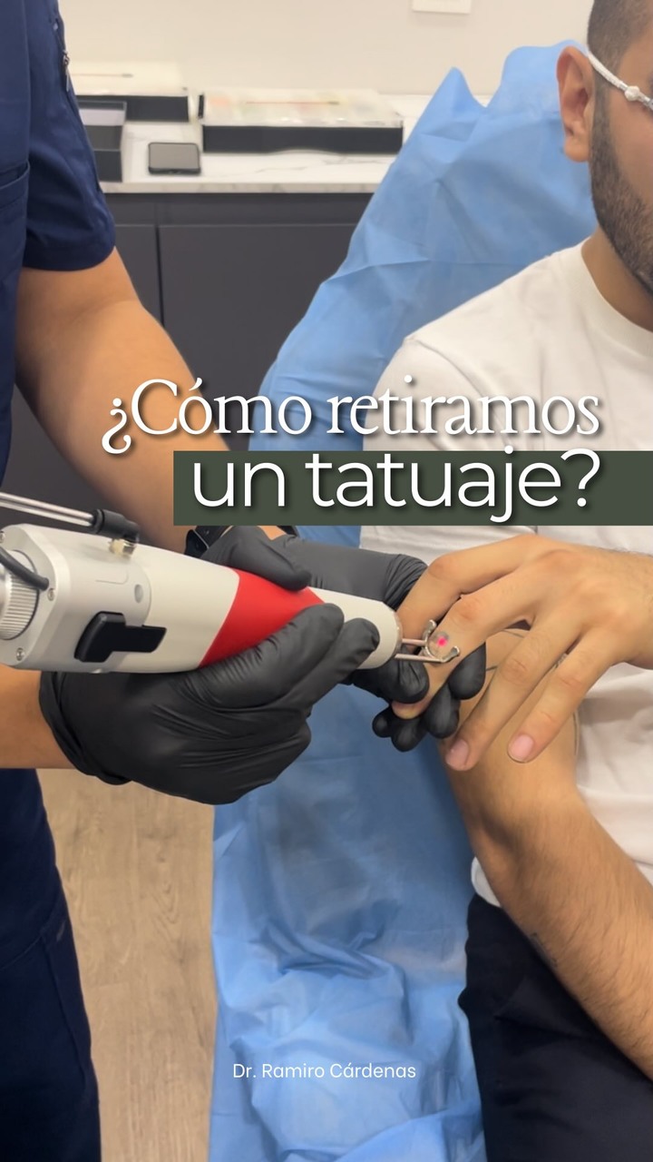Dr. Ramiro Cárdenas Facebook ad: ¿Tienes un tatuaje del que te arrepientes?
