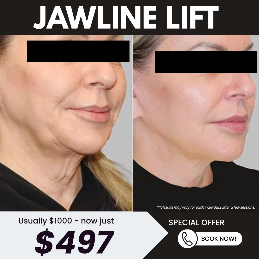 Aesthetics Health & Wellness Medspa Facebook ad: Jawline Lift for Only $497!