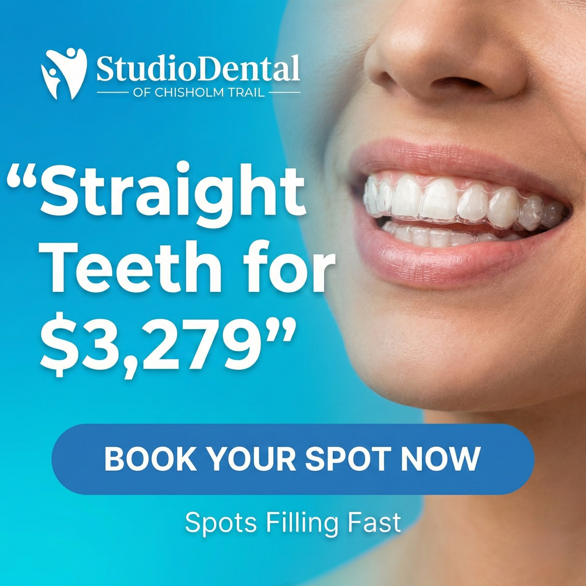 Studio Dental of Chisholm Trail Facebook ad: Hey Fort Worth, Invisalign for Just $3,279 is Here!