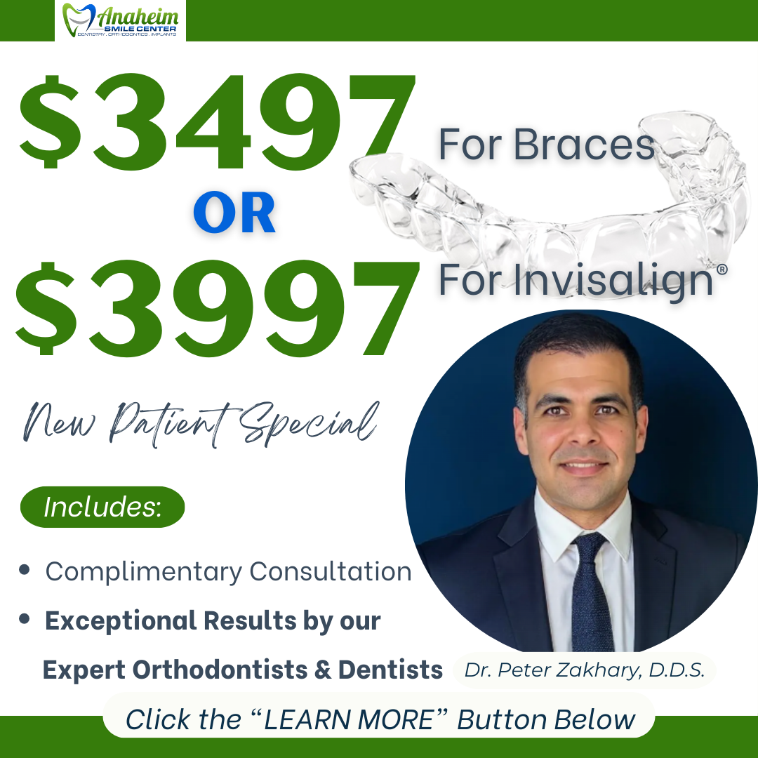 Anaheim Smile Center Facebook ad: $3497 TOTAL for Braces Treatment or $3997 TOTAL for…