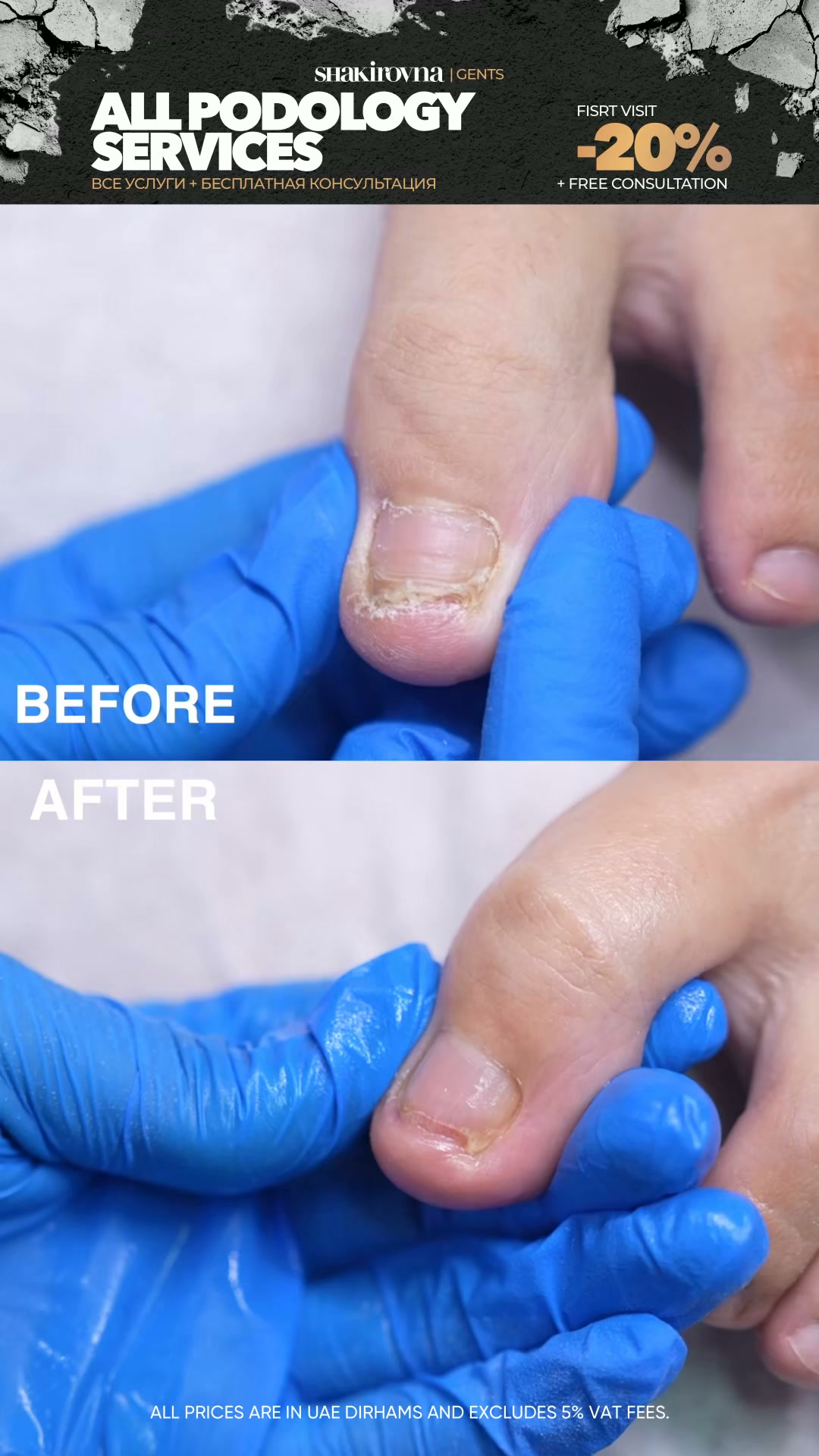Shakirovna Facebook ad: Professional Podology & Medical Foot Care | Dubai…