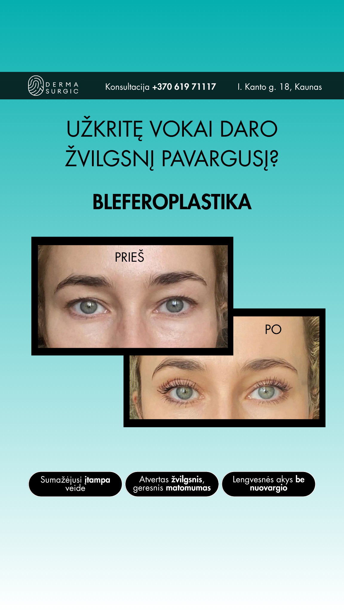 DermaSurgic estetinės medicinos ir chirurgijos centras Facebook ad